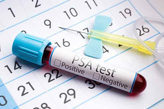 Prostate Cancer Screening