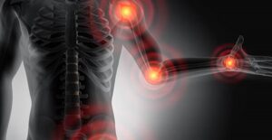 Inflammation pain centers in the joints.