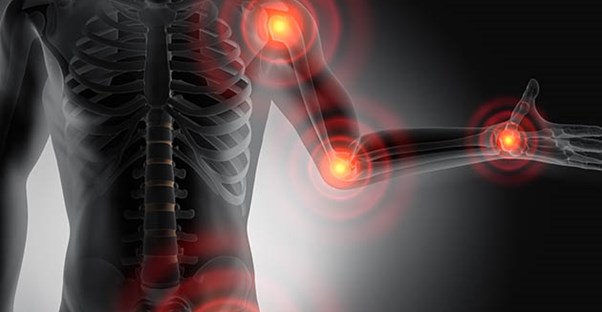 Inflammation pain centers in the joints.