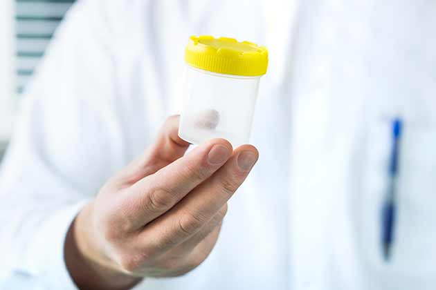 Men: Low sperm count