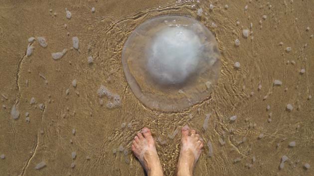 Urine for a Jellyfish Sting