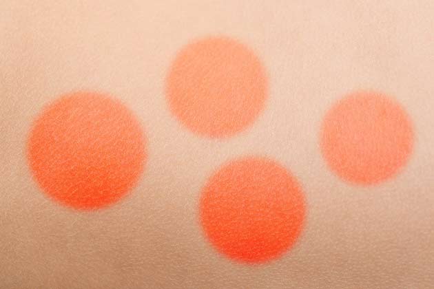 Round, Coin-Shaped Spots