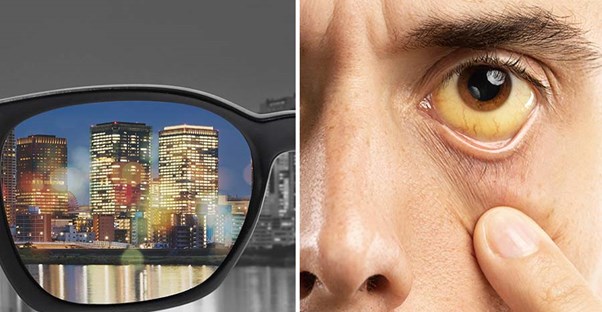 glasses and guy with yellow eyes