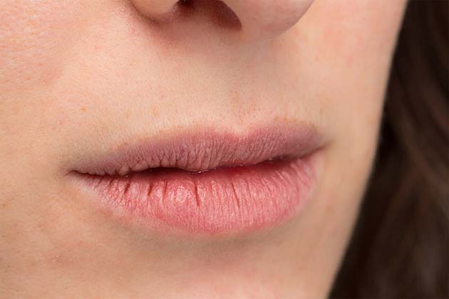 Mouth Blisters