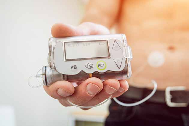 Insulin Pumps
