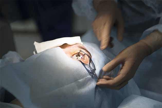 LASIK Surgery
