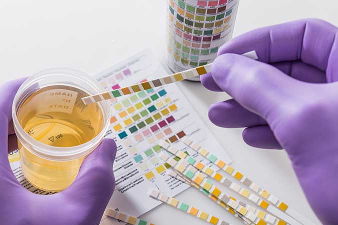 Drug Test Administrator