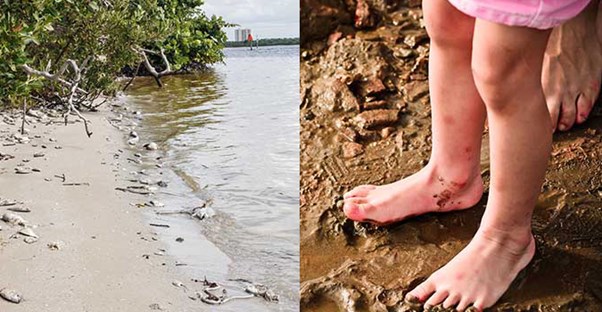 Beach diseases