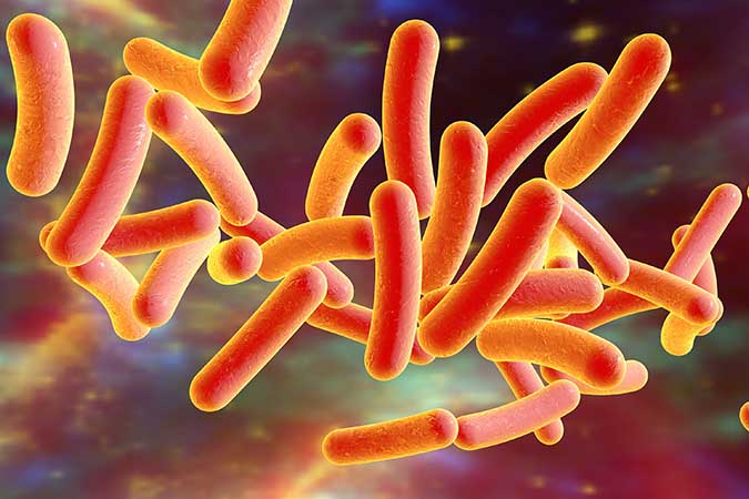 Legionnaire's Disease