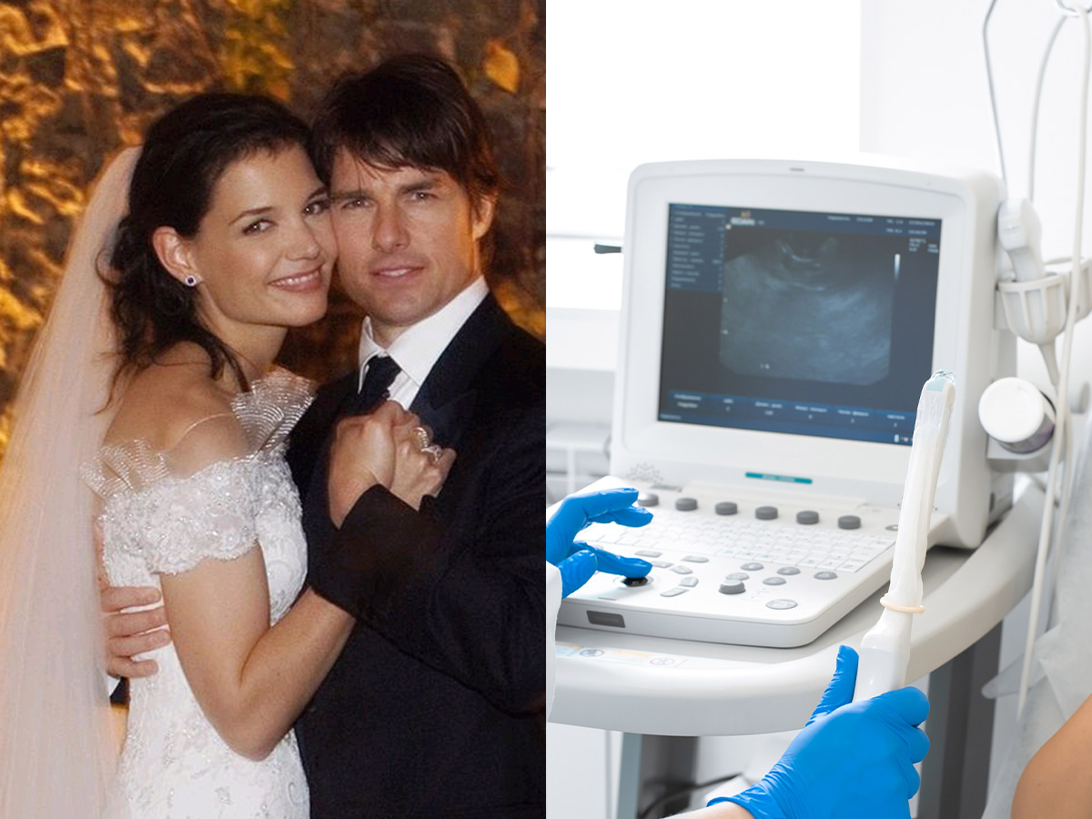 Tom Cruise (A $200,000 Sonogram Machine)