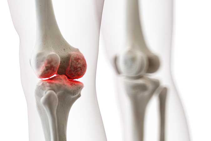 What Happens if Lyme Disease Isn’t Treated?