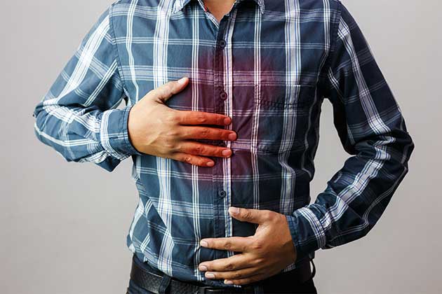 What is Acid Reflux?