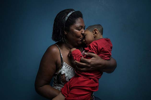 Zika Virus