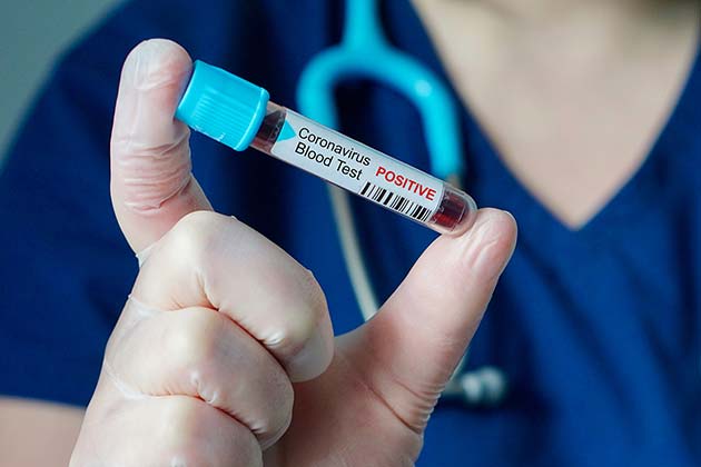 Coronavirus
