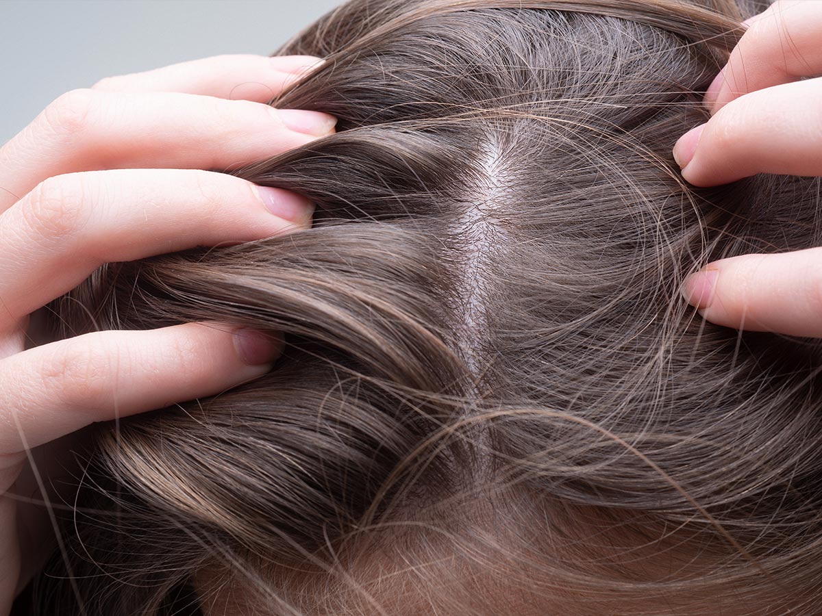 Massage Scalp