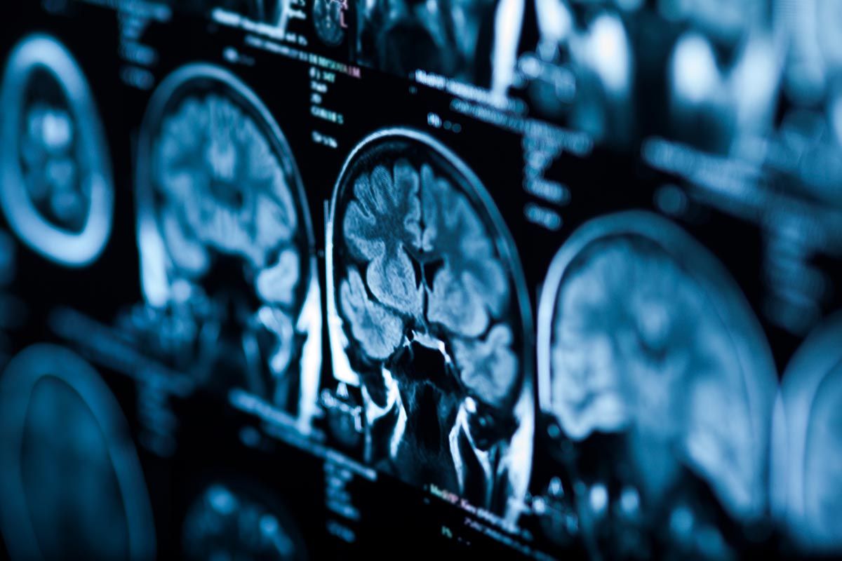 Brain Tincture
