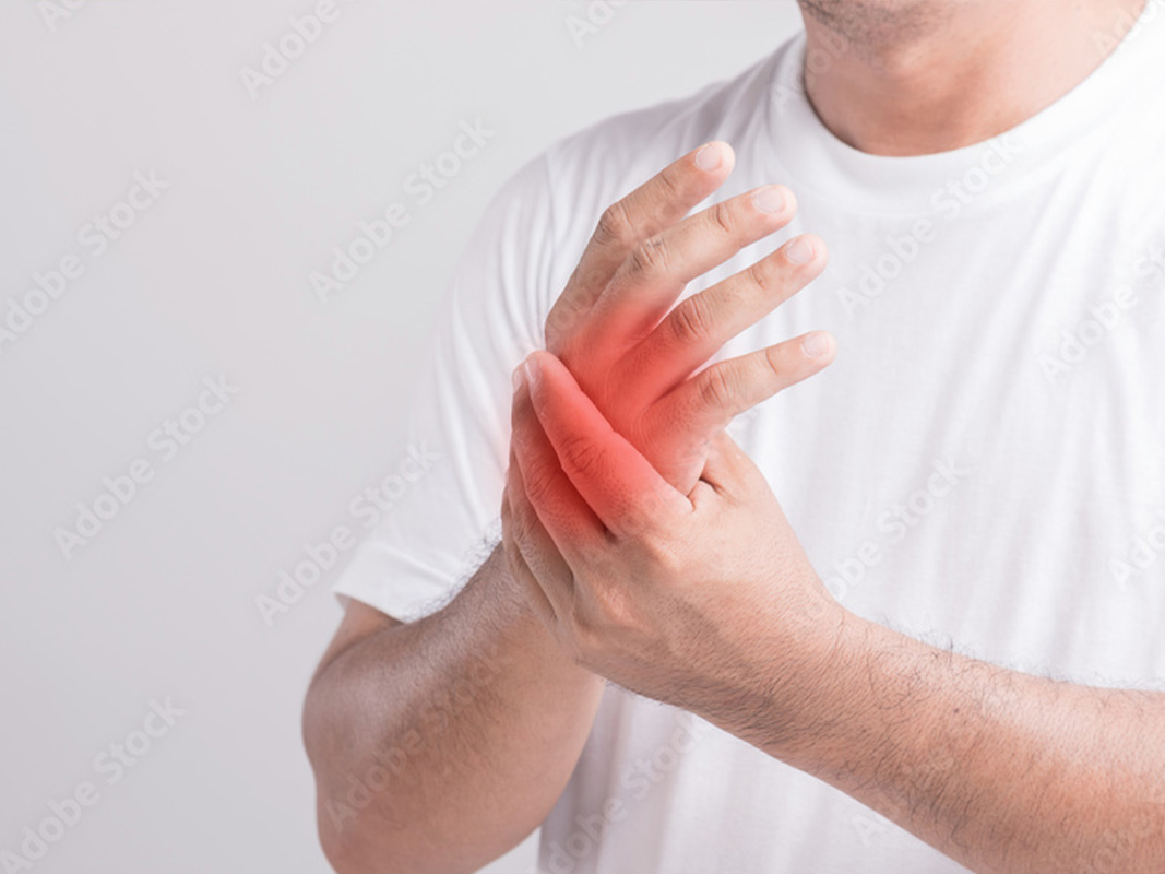 Carpal Tunnel Syndrome