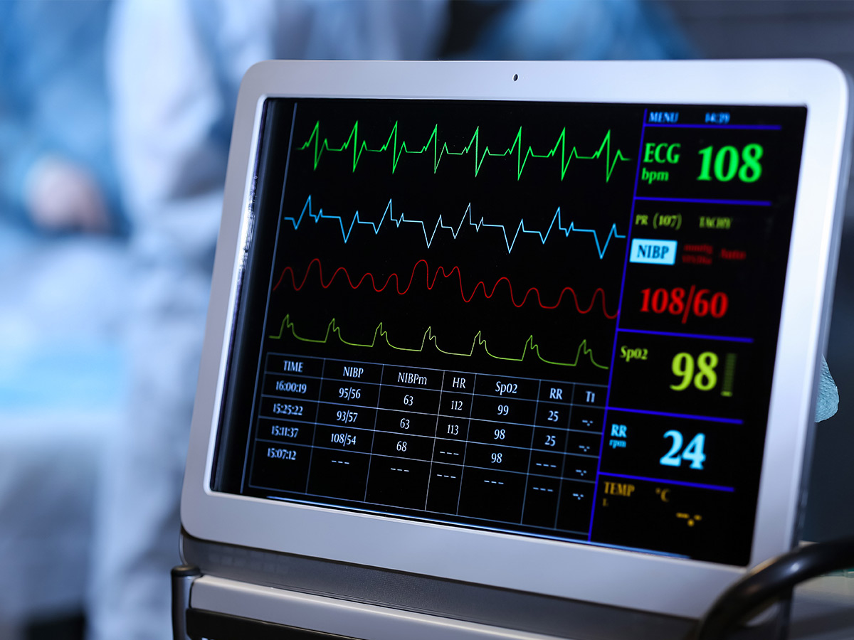 Heart Rate Variability