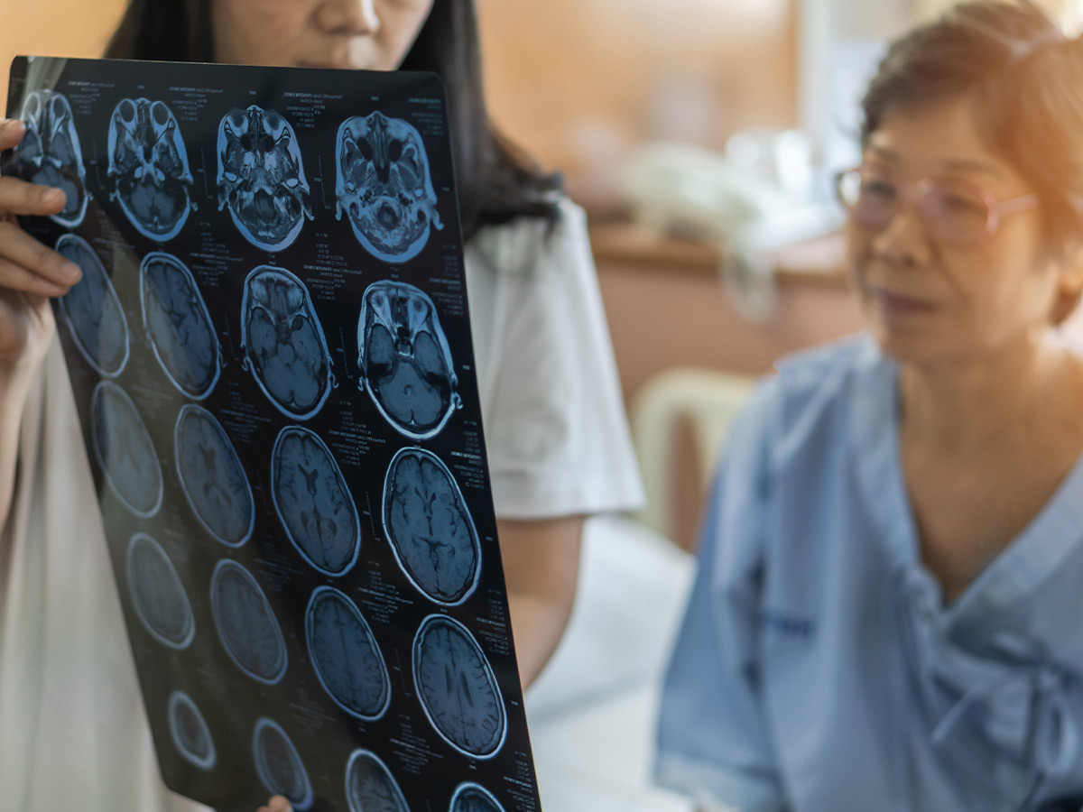 Cerebrovascular Disease
