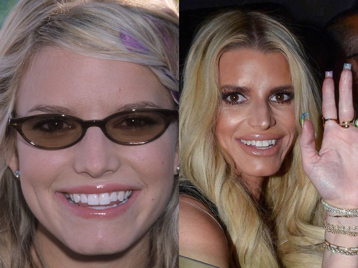 Jessica Simpson