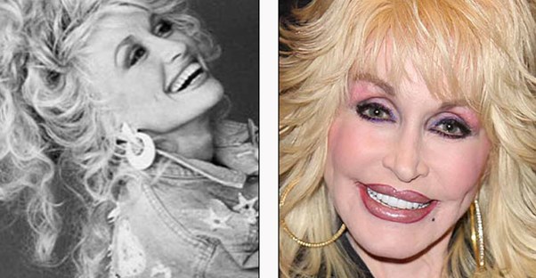 Dolly parton