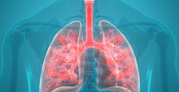 Pneumonia Signs and Symptoms