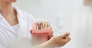 Are Dental Implants Right for Me?