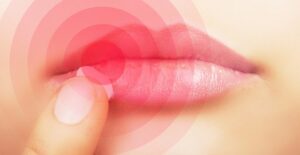 a woman examines a cold sore on her lip