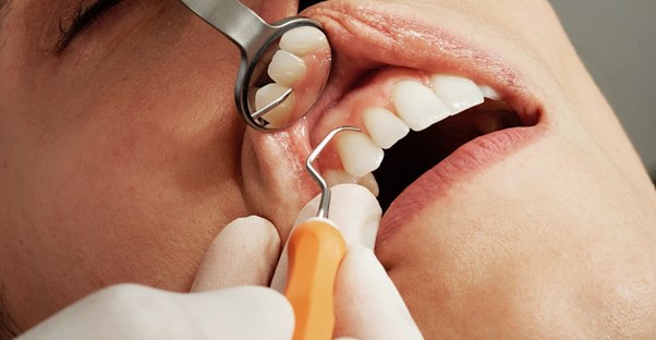 free dental programs