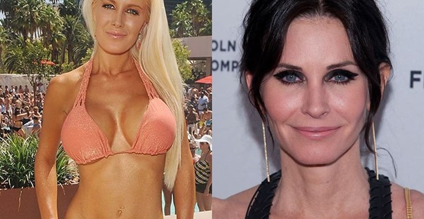 celebrities who reversed cosmetic surgery
