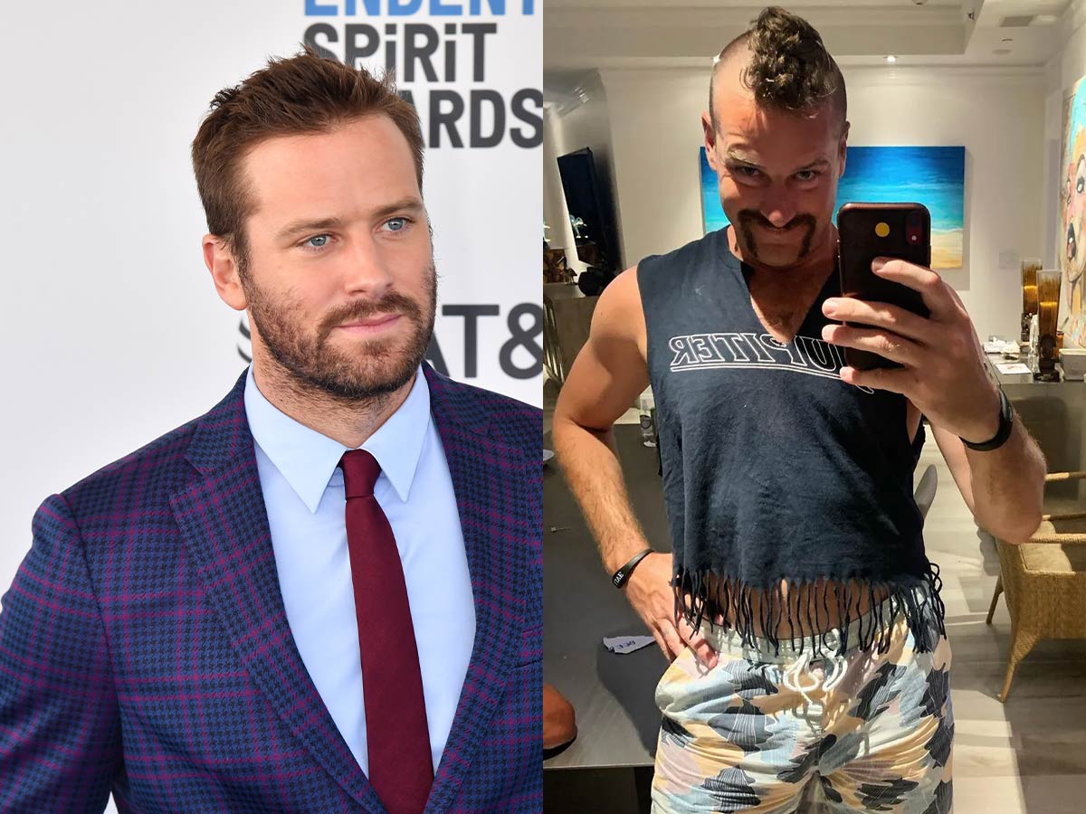 Armie Hammer