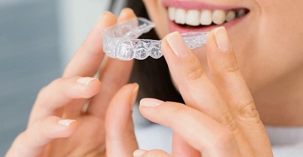 invisalign dental braces