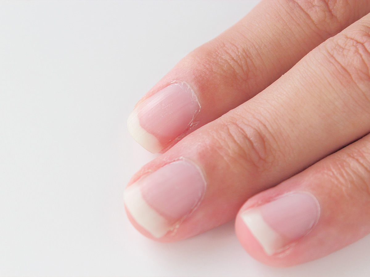 Fingernail Changes