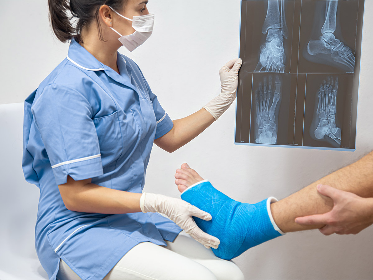 Broken/Fractured Bones: $30,000-$100,000