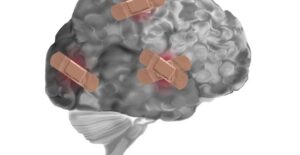 a brain that has endured quite a few concussions