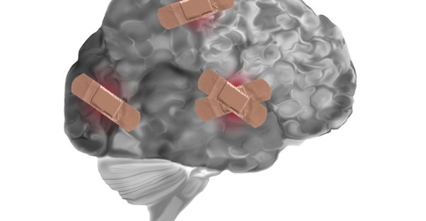 a brain that has endured quite a few concussions