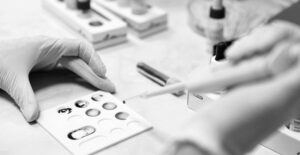 a lab worker diagnosing a case of malaria