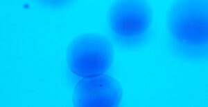 a magnified image of malaria