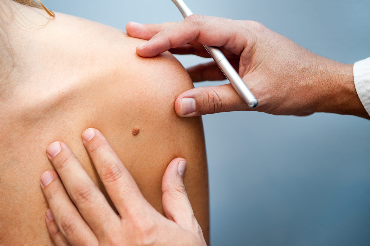Nevada – Skin Cancer