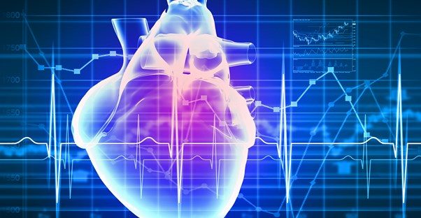 a visual representation of atrial fibrillation