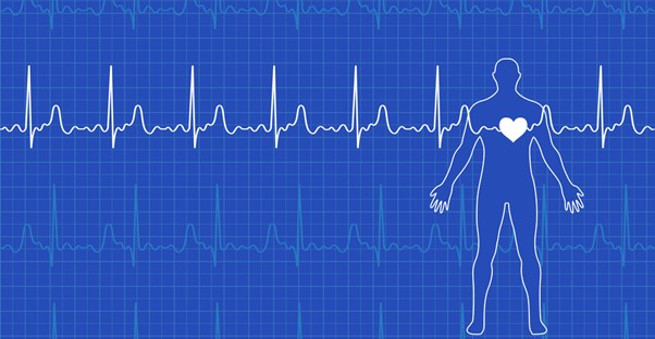 an ECG that may be used to identify the causes of atrial fibrillation