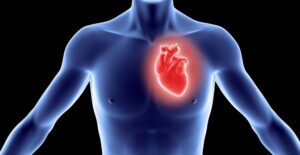 a visual representation of atrial fibrillation