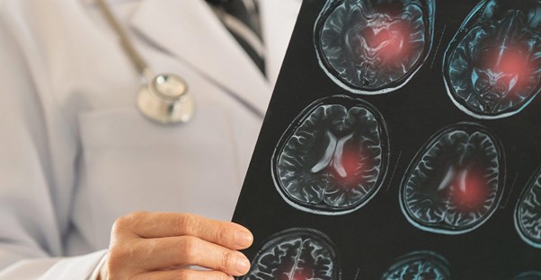 untreated high blood pressure