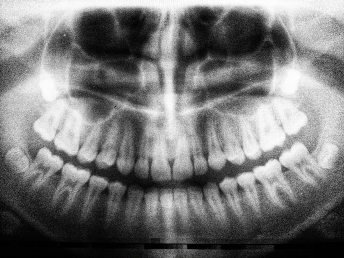 Evolutionary Remnants in Our Bodies