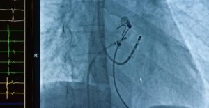 medical imaging from a patient who has a herniated disc