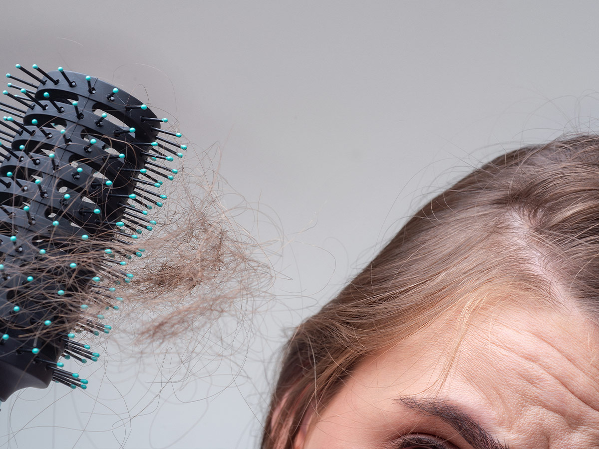 Loss of Hair