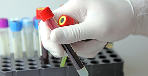 a lab technician working to diagnose syphilis