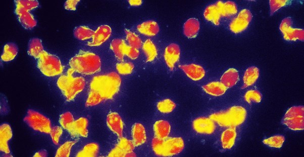 common parasites