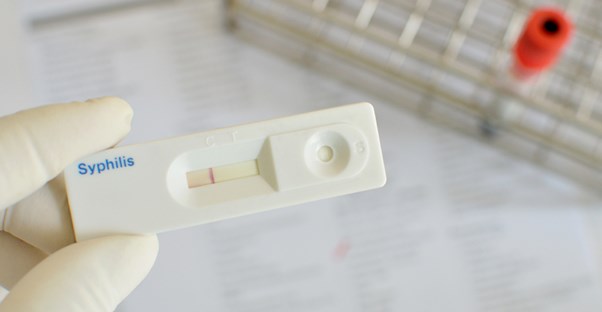 a lab technician testing for syphilis