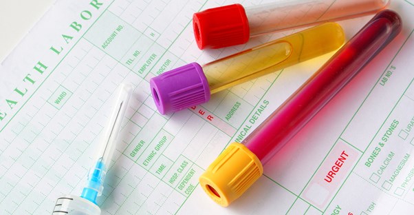 tests used to measure the body's metabolism